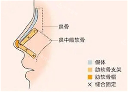 鼻部組織介紹圖片