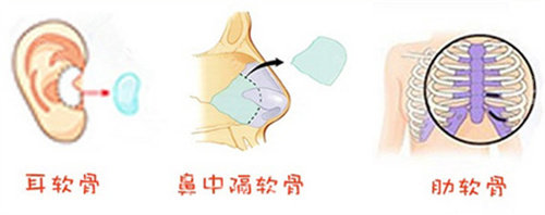 耳軟骨、鼻中隔軟骨、肋軟骨圖片