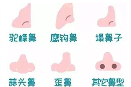 不同鼻型圖片 不同鼻型圖片