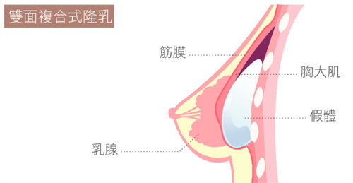 復(fù)合式隆胸圖
