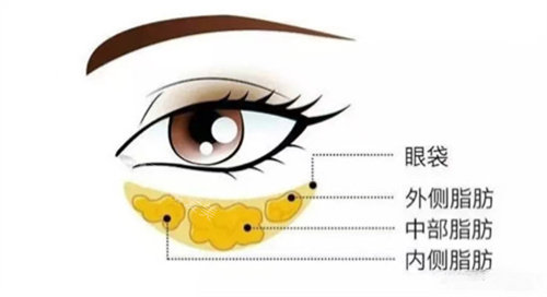 不同部位脂肪位置图片