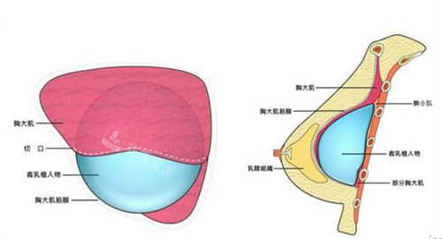 胸内组织位置图片
