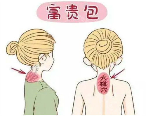 富貴包形象圖