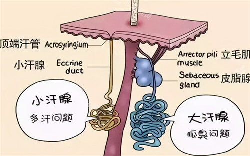 狐臭问题