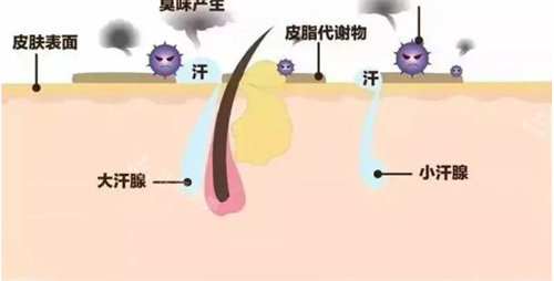 狐臭形成圖 狐臭形成圖