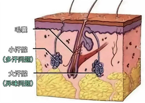 腋下汗腺组织图