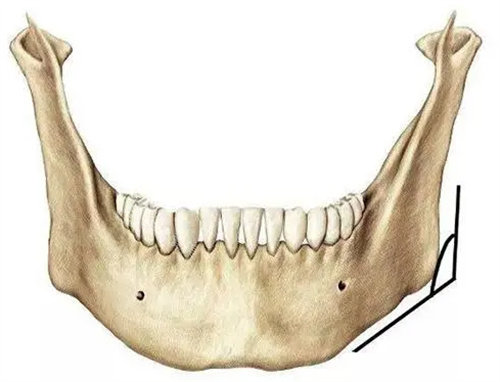 下颌角示意图