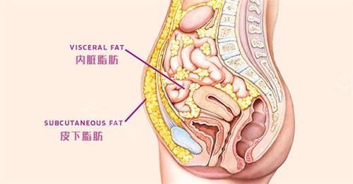 内脏脂肪和皮下脂肪图片