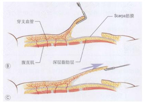 肌肉组织图片