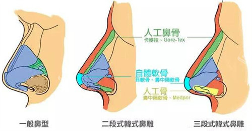 韩国JN整形好不好？