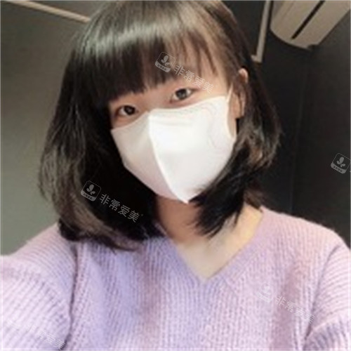 雙眼皮手術(shù)前圖片2 雙眼皮手術(shù)前圖片2