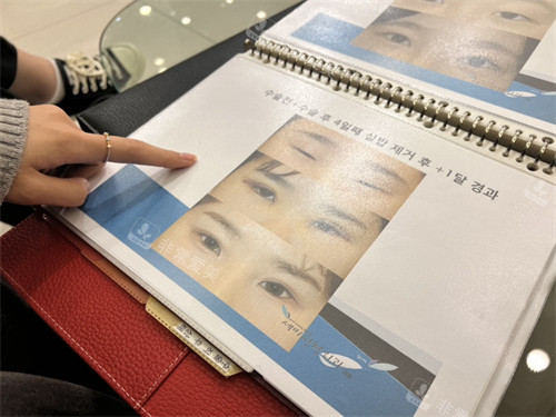 韓國(guó)世美整形外科實(shí)例冊(cè) 韓國(guó)世美整形外科實(shí)例冊(cè)