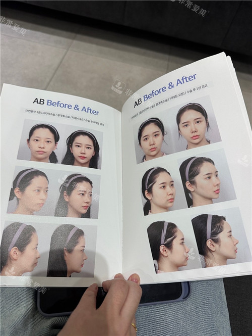 韩国AB整形外科画册