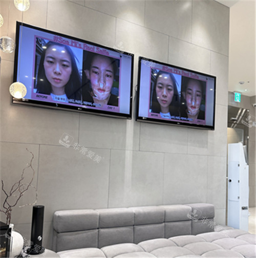 韩国脸本脸骨整形外科环境展示图