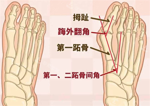 大脚骨结构图