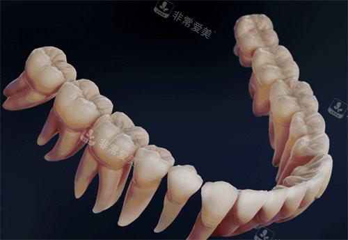 牙齒模型3D打印圖 牙齒模型3D打印圖