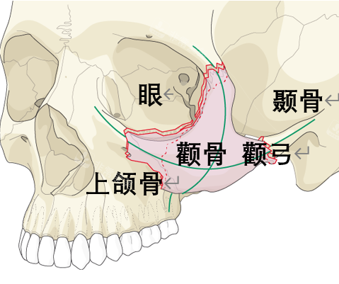 颧骨位置图片