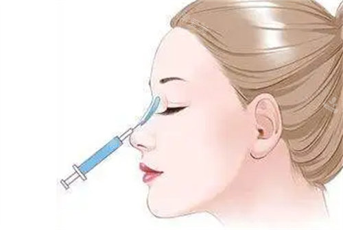注射隆鼻动画图 注射隆鼻动画图