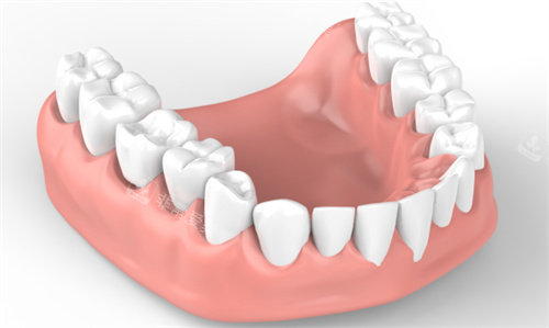 口腔模型展示圖