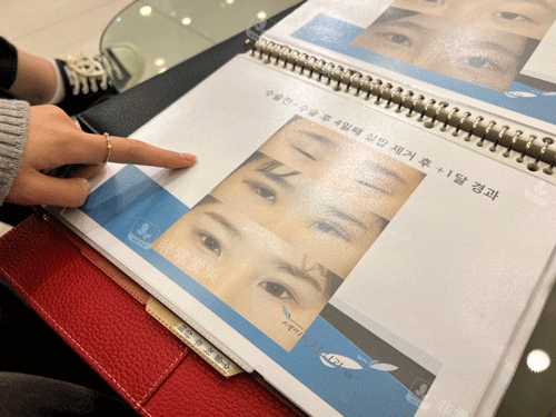 韩国世美整形手术宣传册子