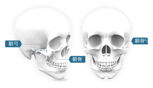 顴骨顴弓圖片 顴骨顴弓圖片