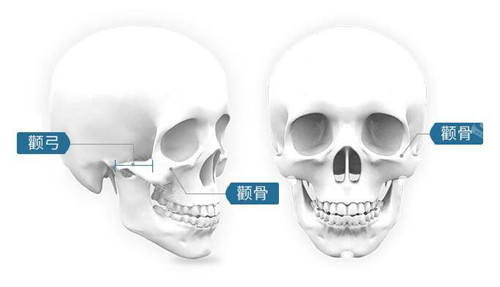 颧骨图片