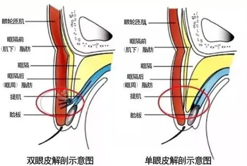 單眼皮與雙眼皮解剖對(duì)比圖 單眼皮與雙眼皮解剖對(duì)比圖
