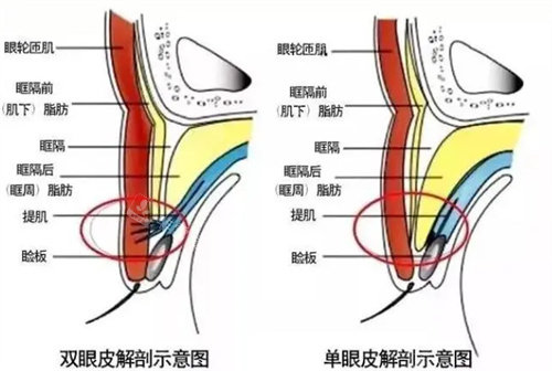 單眼皮與雙眼皮解剖對比圖