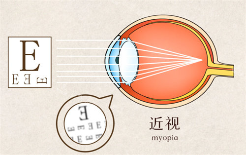 近视成像演示图