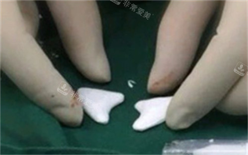 硅膠圖片 硅膠圖片