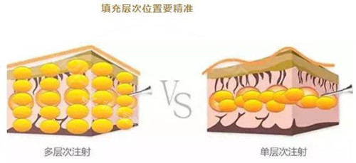 填充層次圖片 填充層次圖片