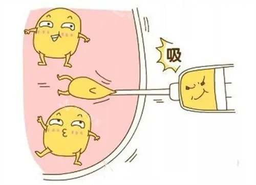吸脂術(shù)圖片 吸脂術(shù)圖片