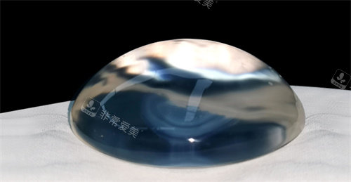 圓形高凸假體示例圖 圓形高凸假體示例圖