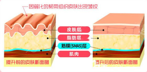 皮膚皺紋內部圖片