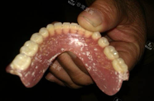 牙齒照片 牙齒照片
