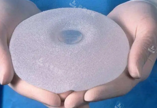 圆形假体照片 圆形假体照片
