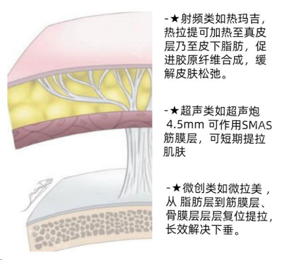 皮膚筋膜層示意圖 皮膚筋膜層示意圖