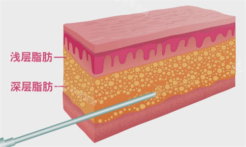 深层脂肪与浅层脂肪分布图