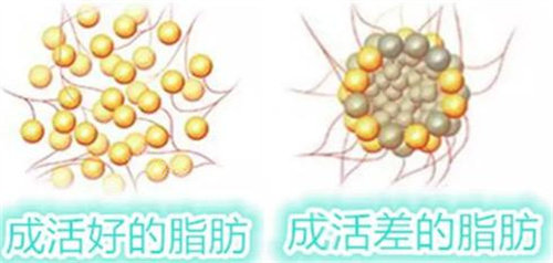 成活好的脂肪圖 成活好的脂肪圖
