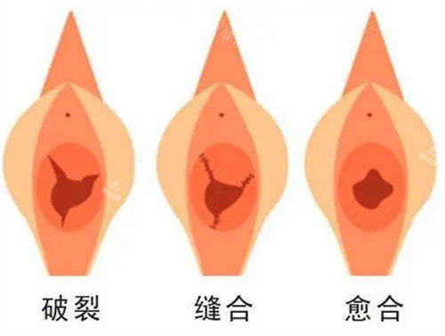 私密術(shù)