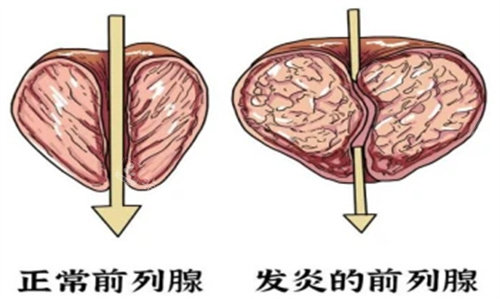 前列腺展示图