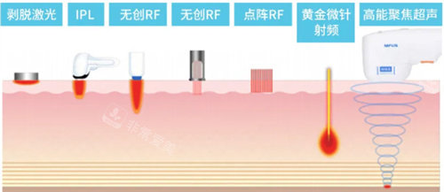 抗衰项目都有哪些？