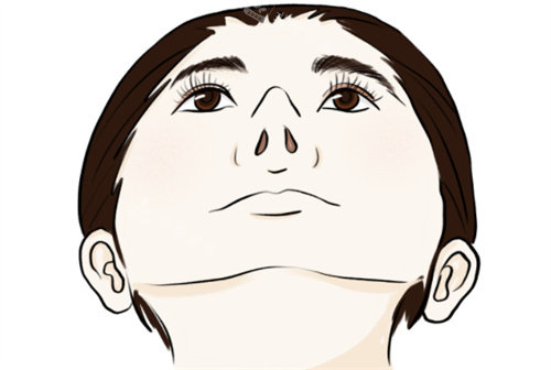 隆鼻仰視動(dòng)畫圖