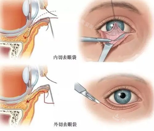 潮州来丽医疗美容是正规的吗？整友评价正规靠谱技术出色