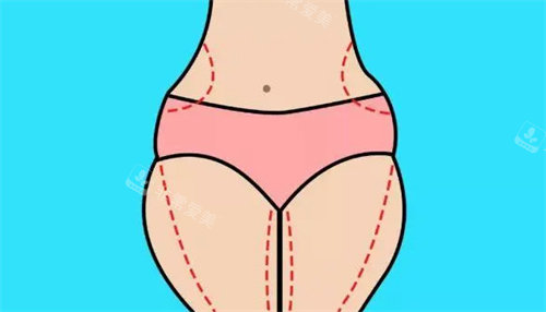 腰腹大腿吸脂动画展示图 腰腹大腿吸脂动画展示图