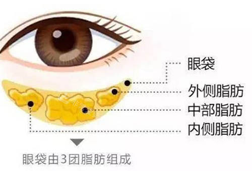 武汉金国华修复双眼皮怎么样？曝光金国华做整形真实评价