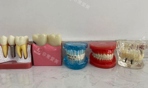 牙齿模具图 牙齿模具图