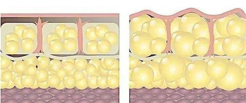 身体脂肪结构组成图