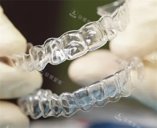 隐形牙套照片 隐形牙套照片