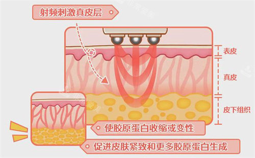 熱瑪吉示意圖 熱瑪吉示意圖
